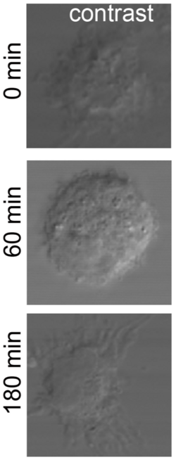 Célula dendrítica observada mediante microscopía de contraste de fases