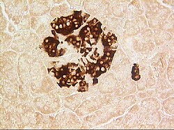 Immunohistoquímica de estreptavidina-biotina para detectar insulina