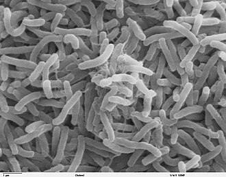 Vibrio cholerae, la bacteria que causa el cólera bajo imagen SEM