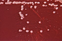 Colonias de Pseudomonas aeruginosa en medio de cultivo XLD agar