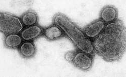 Imagen al microscopio del virus