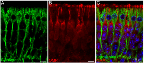 Identificación de marcadores antigénicos en epitelio olfatorio mediante inmunofluorescencia y microscopía confocal