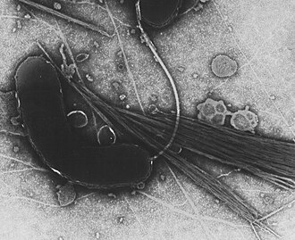 Microscopio electrónico de transmisión imagen de Vibrio cholerae