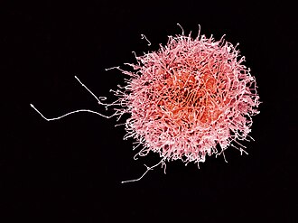 Micrografía electrónica de una célula NK