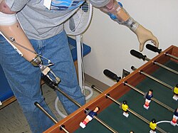 Persona con dos miembros protésicos jugando al futbolín
