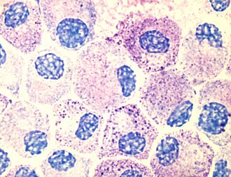 Mastocitos observados bajo microscopio óptico