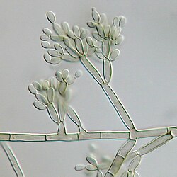 Imagen microscópica del moho Fonsecaea