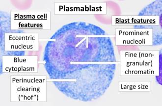Plasmablasto