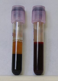 Tubos de ensayo con muestras de sangre