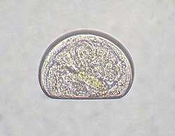 Larva de bivalvo en su entorno