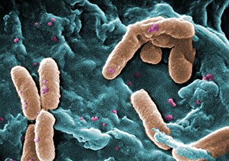 Imagen microscópica de barrido de Pseudomonas aeruginosa