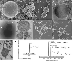 Caracterización microscópica y composición lipídica de las arqueas Asgard