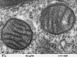 Imagen obtenida por microscopía electrónica de dos mitocondrias