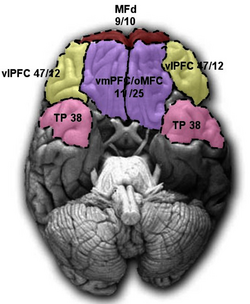 Ejes ventral-medial y ventral-lateral en estructuras anatómicas complejas.