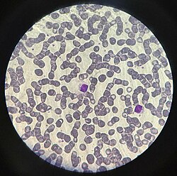 Linfocitos rodeados de eritrocitos en microscopía óptica