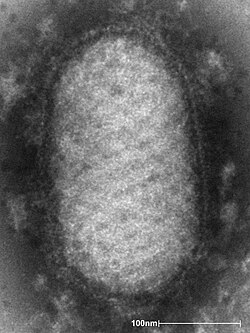 Micrografía electrónica de un Parapoxvirus mostrando su morfología.
