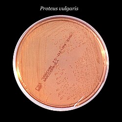 Placa de Petri con agar McConkey sólido y un inóculo en estría de Proteus vulgaris.