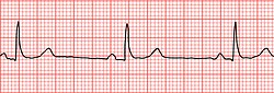 Electrocardiograma