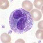 Eosinófilo, una célula del sistema inmunitario