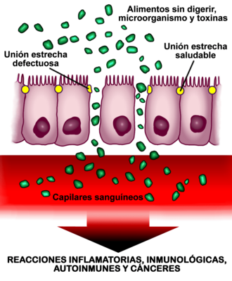 Esquema de la pared del intestino con permeabilidad aumentada