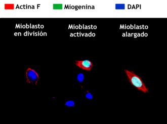Mioblastos en etapas de su diferenciación.