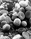 Muestra de sangre humana en microscopía electrónica