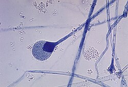 Imagen microscópica del moho Mucor