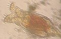 Micrografía de un rotífero