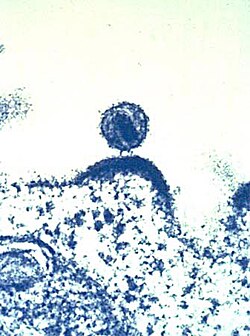Virus del VIH magnificado a través de un microscopio electrónico