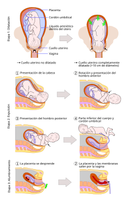Esquema ilustrativo de las etapas del parto