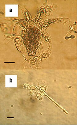 Zoosporangios de Batrachochytrium dendrobatidis visibles como cuerpos esféricos en muestras de laboratorio