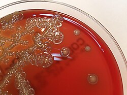 Cultivo bacteriano en un medio de agar sangre.