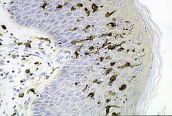 Sección de la piel mostrando células dendríticas en la epidermis
