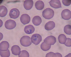Trofozoítos de Plasmodium