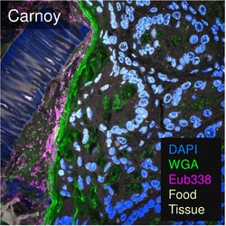 Micrografía mostrando el medio ambiente intestinal conformado por el hospedador, microbios y alimentos.