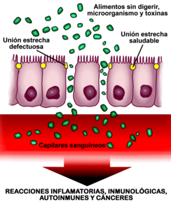 Esquema de la pared intestinal con permeabilidad aumentada