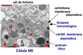 Célula NK con gránulos líticos