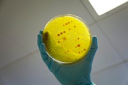 Conteo de microorganismos en laboratorio