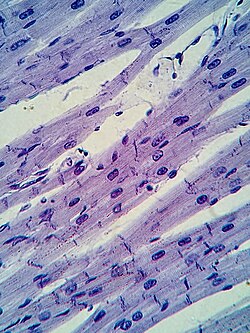 Preparación histológica de músculo cardiaco visto bajo el microscopio óptico